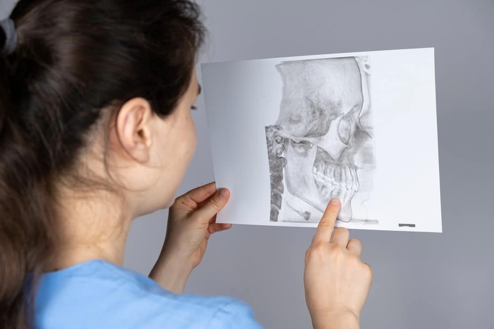 What is TMJ X-ray image of a jaw structure, featuring Sleep Better Columbus and highlighting "What is TMJ" to provide visual context for temporomandibular joint information.<br />